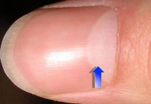 Znate li šta znači ovaj bijeli polumjesec na vašim noktima, evo odgovora