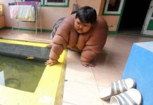 Sjećate li se najdebljeg dječaka, smršao je 100 kg i sada izgleda nevjerovatno