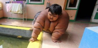 Sjećate li se najdebljeg dječaka, smršao je 100 kg i sada izgleda nevjerovatno