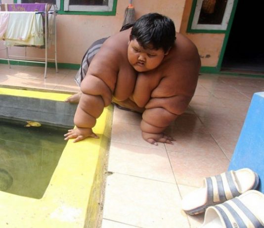 Sjećate li se najdebljeg dječaka, smršao je 100 kg i sada izgleda nevjerovatno