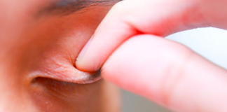 Nosila je maskaru preko 20 godina i nikada nije oprala lice, strasno je kako joj izgleda ispod kapaka