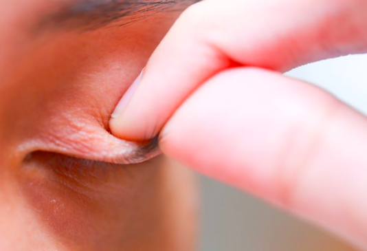 Nosila je maskaru preko 20 godina i nikada nije oprala lice, strasno je kako joj izgleda ispod kapaka