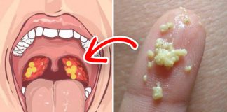 Ovih 6 alarmatnih simptoma na krajnicima ne treba zanemariti