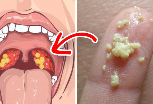 Ovih 6 alarmatnih simptoma na krajnicima ne treba zanemariti