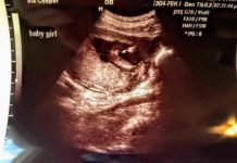 ISPOVIJEST: KADA SAM OTIŠLA NA ULTRAZVUK U 16. SEDMICI TRUDNOĆE: Kad su mi rekli šta nosim, SRCE MI JE POTONULO, morala sam to da krijem od svih