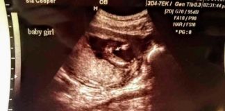 ISPOVIJEST: KADA SAM OTIŠLA NA ULTRAZVUK U 16. SEDMICI TRUDNOĆE: Kad su mi rekli šta nosim, SRCE MI JE POTONULO, morala sam to da krijem od svih