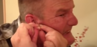 Istisnuo je veliku bubuljicu ispred ogledala: Ko smije da vidi na šta je ono ličilo nakon toga? (VIDEO)