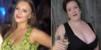 Žene iskreno ispričale: ‘Velike grudi zagorčavaju nam život, bojimo se da će nas ugušiti’